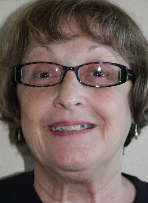 Janice Full Face Before