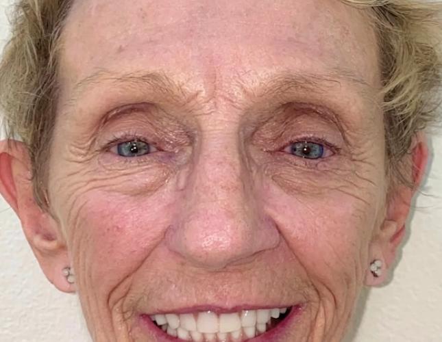 Bethany Full Face After