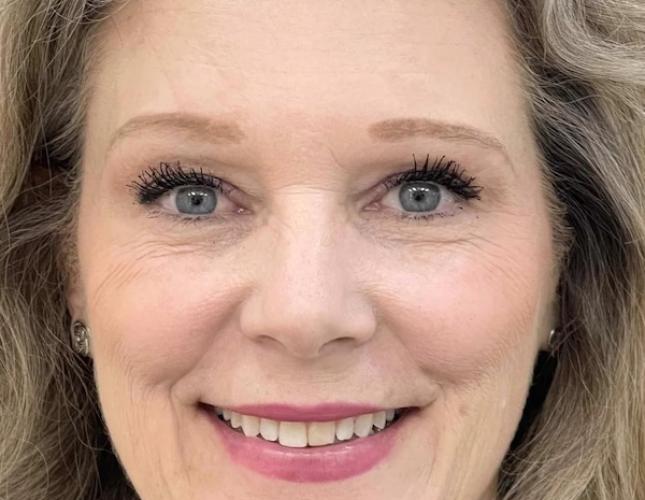 Betty Ann Full Face Before