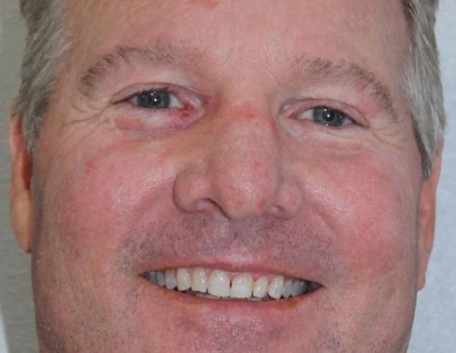 Brett Full Face Before