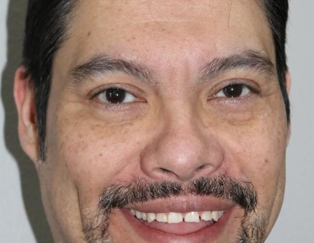 David Full Face Before