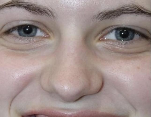 Devin Full Face After