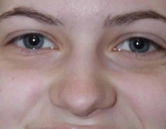 Devin Full Face Before