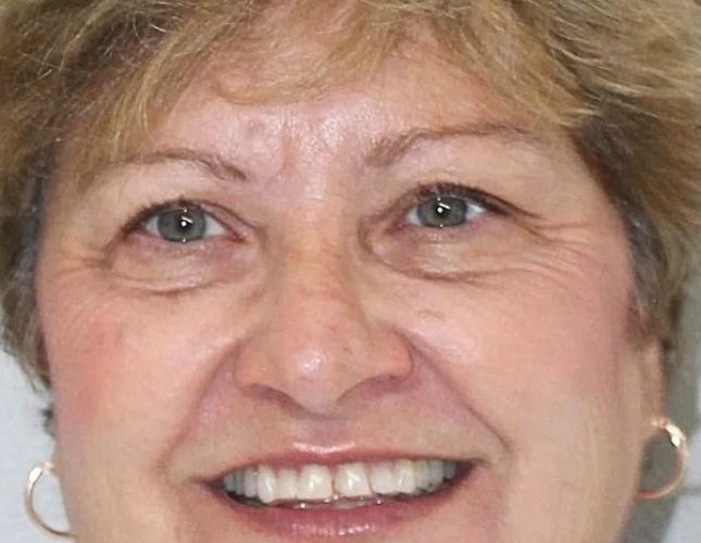 Diane Full Face Before