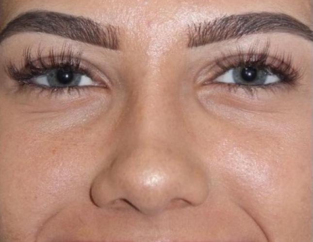 Gigi Full Face After