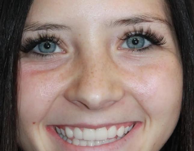 Jade Full Face After