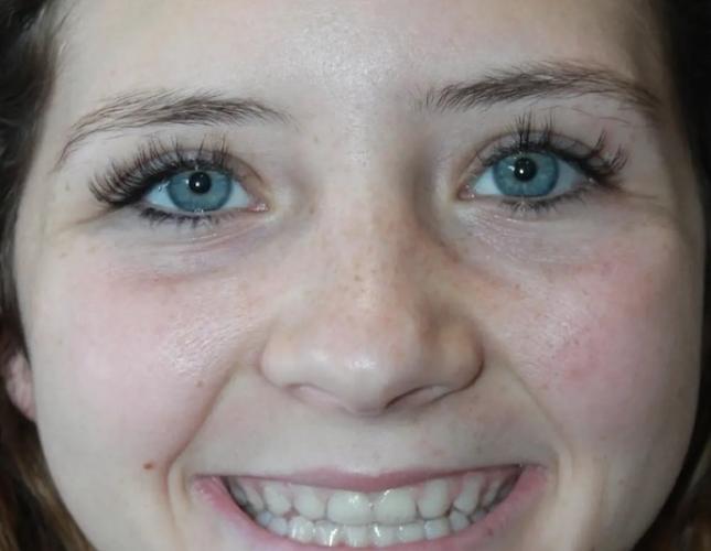 Jade Full Face Before