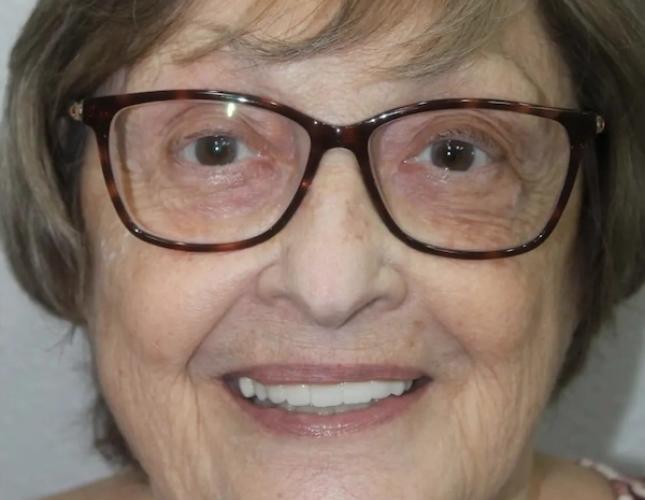 Janice Full Face After