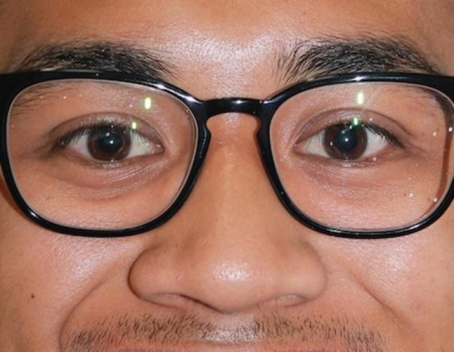 Justin Full Face After