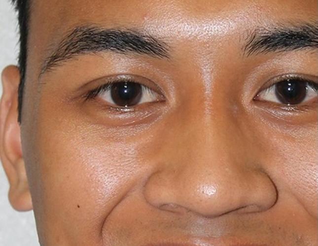 Justin Full Face Before