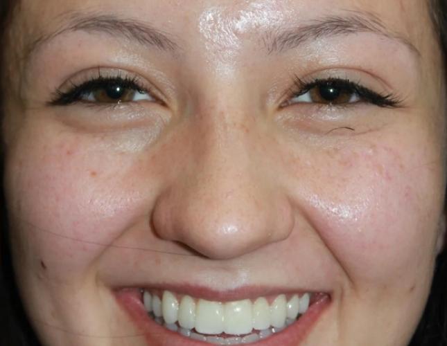 Madison Full Face After
