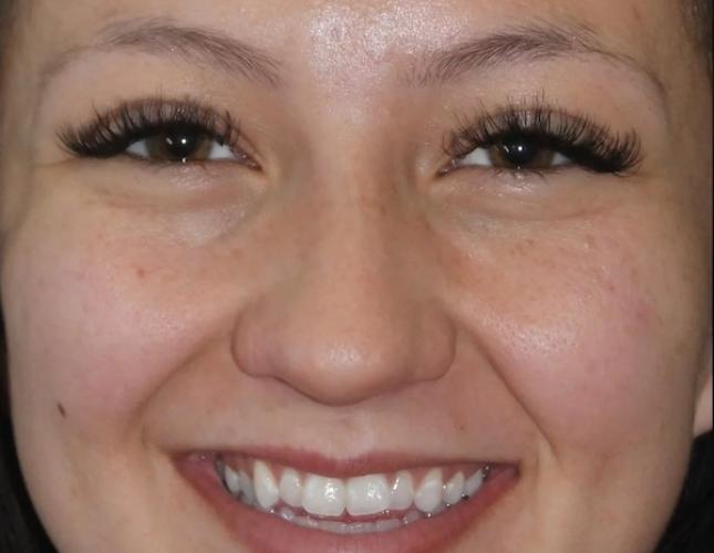 Madison Full Face Before