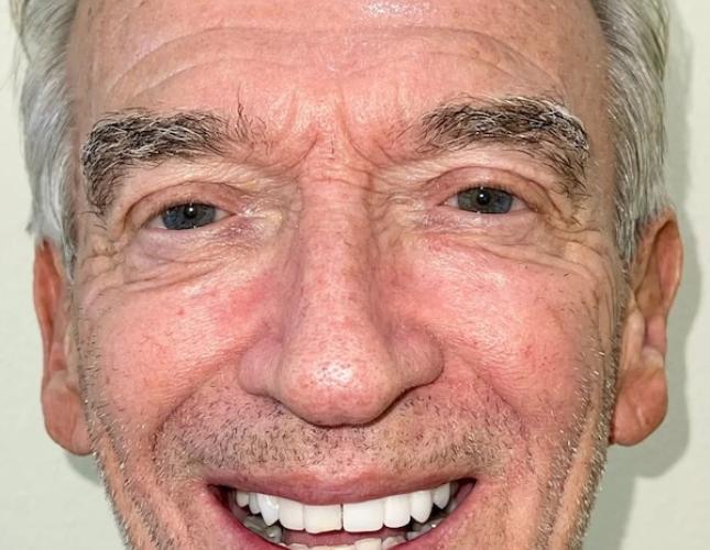 Michael Full Face After