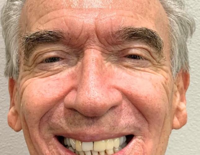 Michael Full Face Before