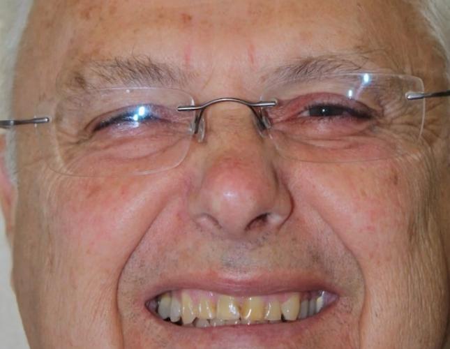 Perlick Full Face Before