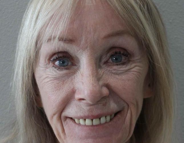 Karen Full Face Before