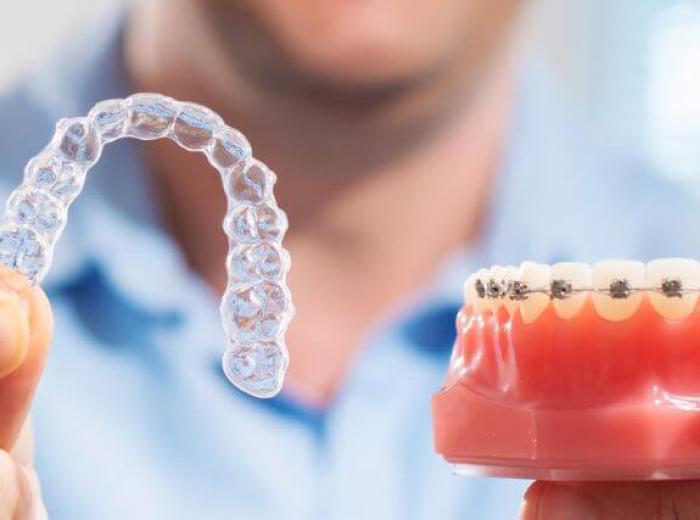 Invisalign® vs. Traditional Braces: Which Orthodontic Treatment Is Right for You?